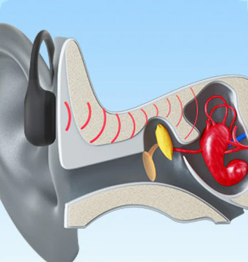 Ear structure